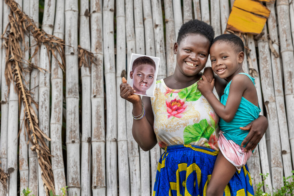 Operation Smile